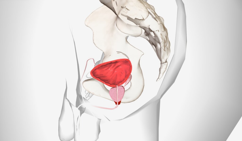  Prostate Enlargement (Benign prostatic hyperplasia - BPH)