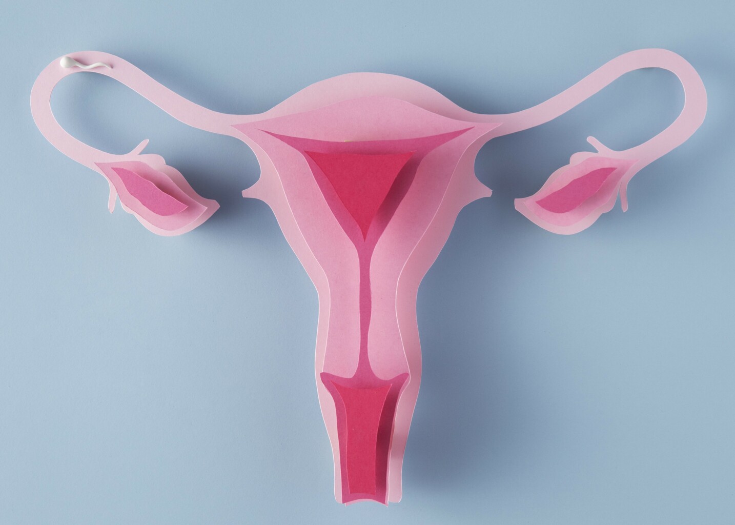 Female sterilization (Tubal ligation)